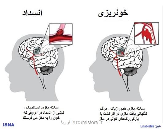 اصلی ترین عامل خطر سکته مغزی در همه کشورها